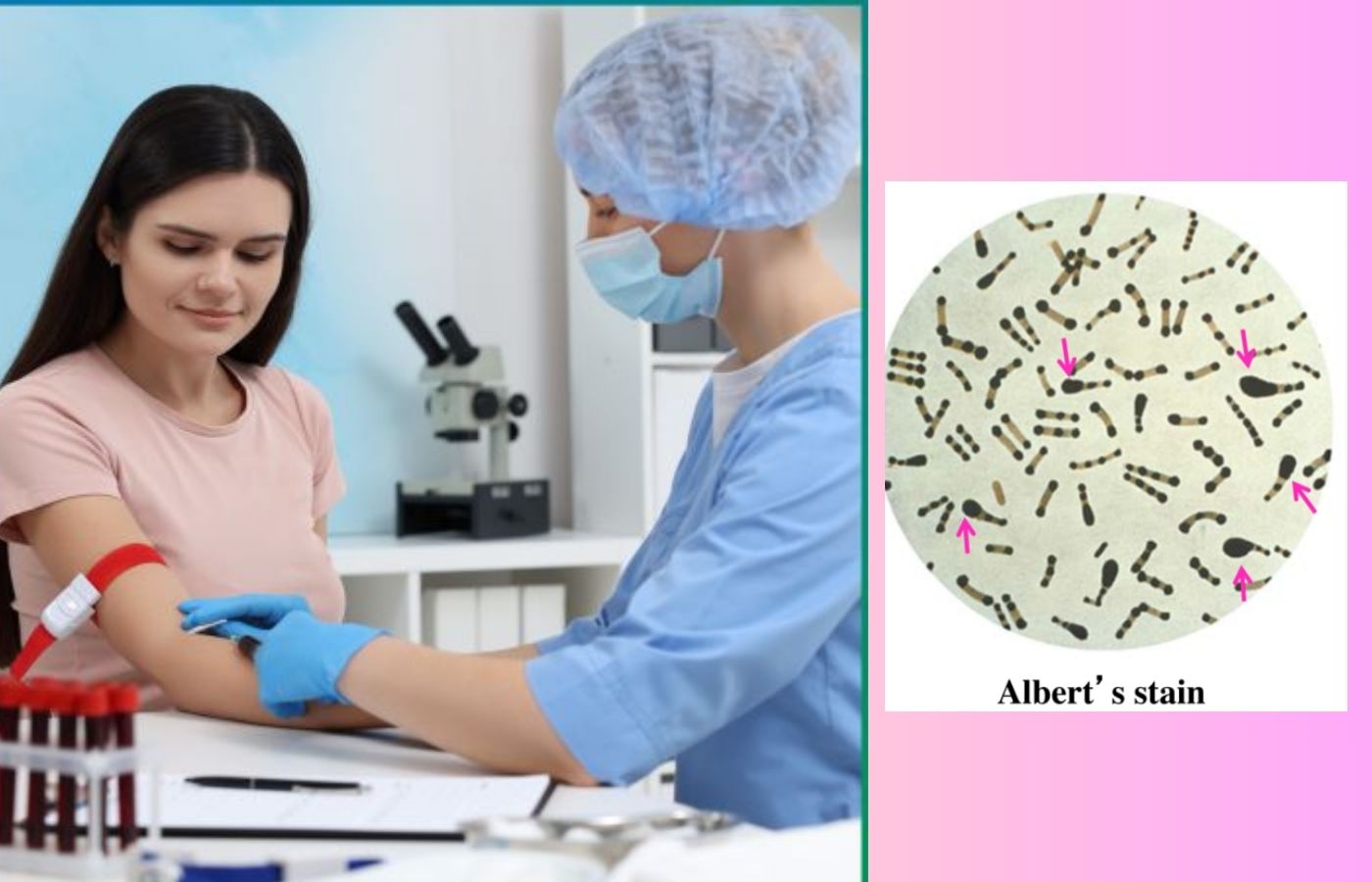 Albert Stain Test 